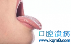 舌癌初期症状都是口腔溃疡，什么样的人容易得舌癌？