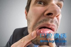经常性的口腔溃疡怎么回事？什么原因导致的？