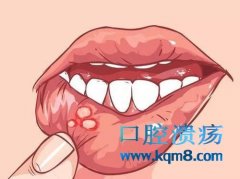 口腔溃疡的临床表现有哪些？
