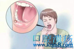 口腔溃疡超一月当心是口腔癌