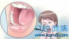 口腔溃疡频繁发作怎么办？一招教您治口疮！