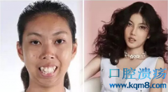 泰国选丑节目泰国妹子Namtip Hingong前后对比照爆红