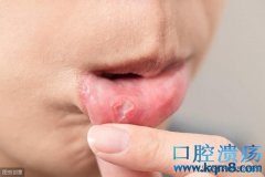 口腔癌早期有什么症状？
