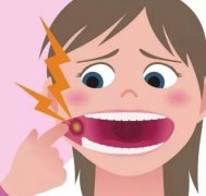 口腔溃疡反反复复发作，也许是因为这些发病原因！