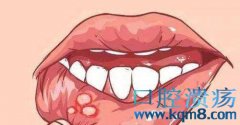 口腔溃疡，牙痛，牙龈肿痛，舌头等口唇舌部位的症状处理方法？